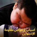 عيش بصحة- مقاومة الإنسولين: 10 الأعراض والأسباب والعلاج وعلاقتها بزيادة الوزن ودهون البطن أعراض مقاومة الإنسولين وأبرز علاماتها في الجسم